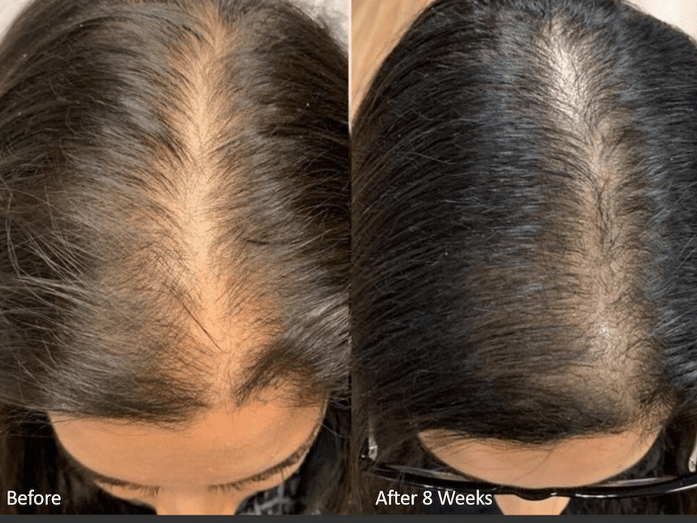 PeptideScience user 1 — part density, day 1 vs week 8