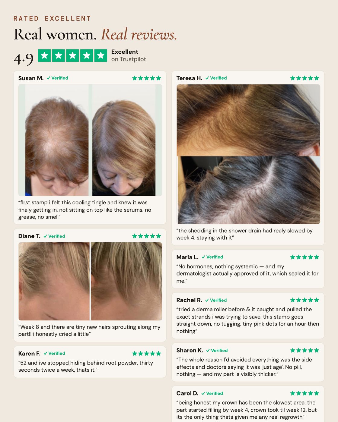 Rated 4.9 Excellent on Trustpilot — real reviews from verified Peptide Root Activator buyers