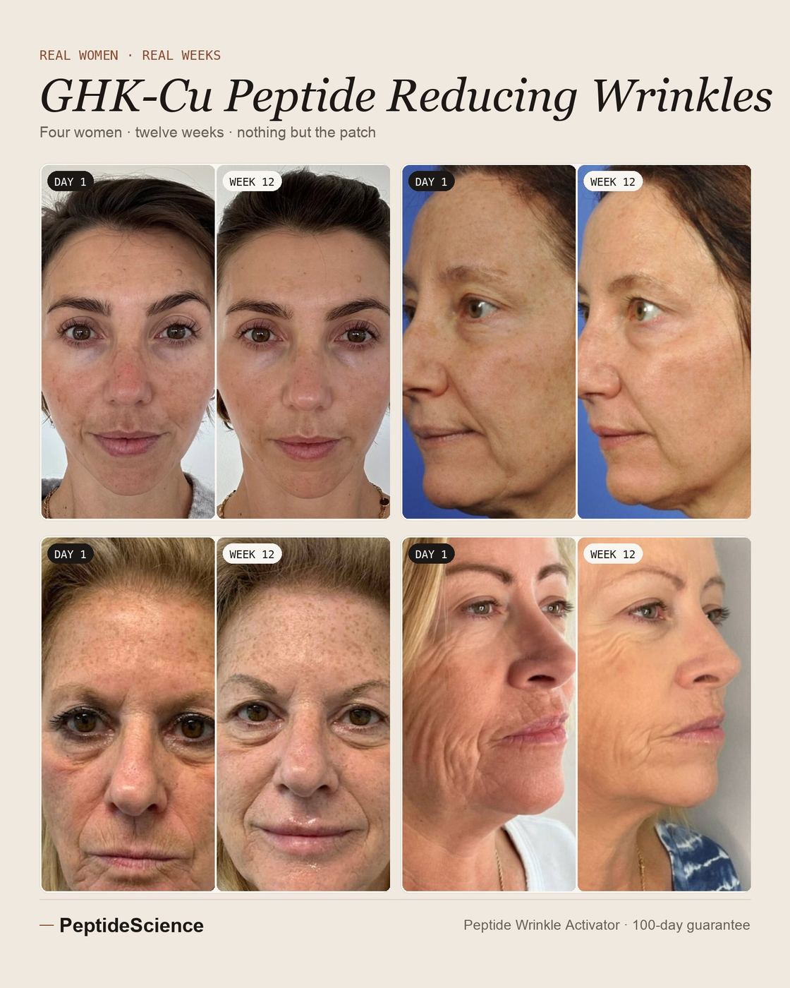 Past the barrier — four women, day 1 to week 12 with the Peptide Wrinkle Activator: under-eye, profile, full face and smile lines
